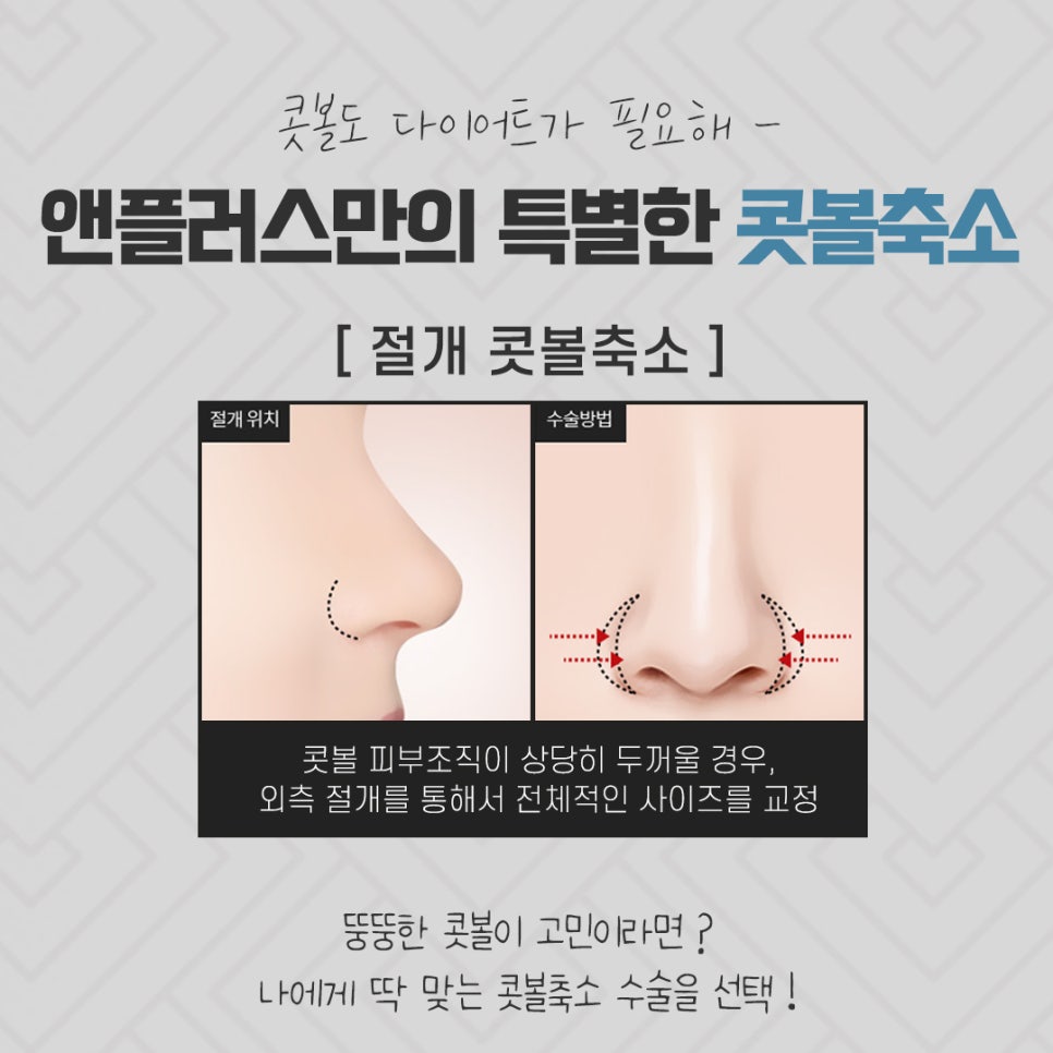 Reviewing Nostril Reduction Results and Improving Your Appearance image 10