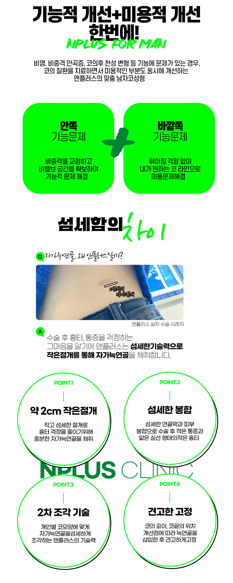앤플러스의원 남자코성형 이벤트 관련 이미지 4