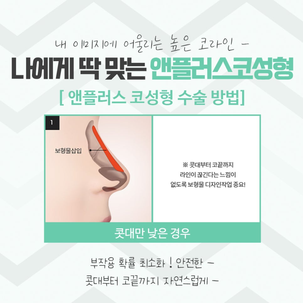 코성형후기 자연스러운 코라인으로 관련 이미지 9