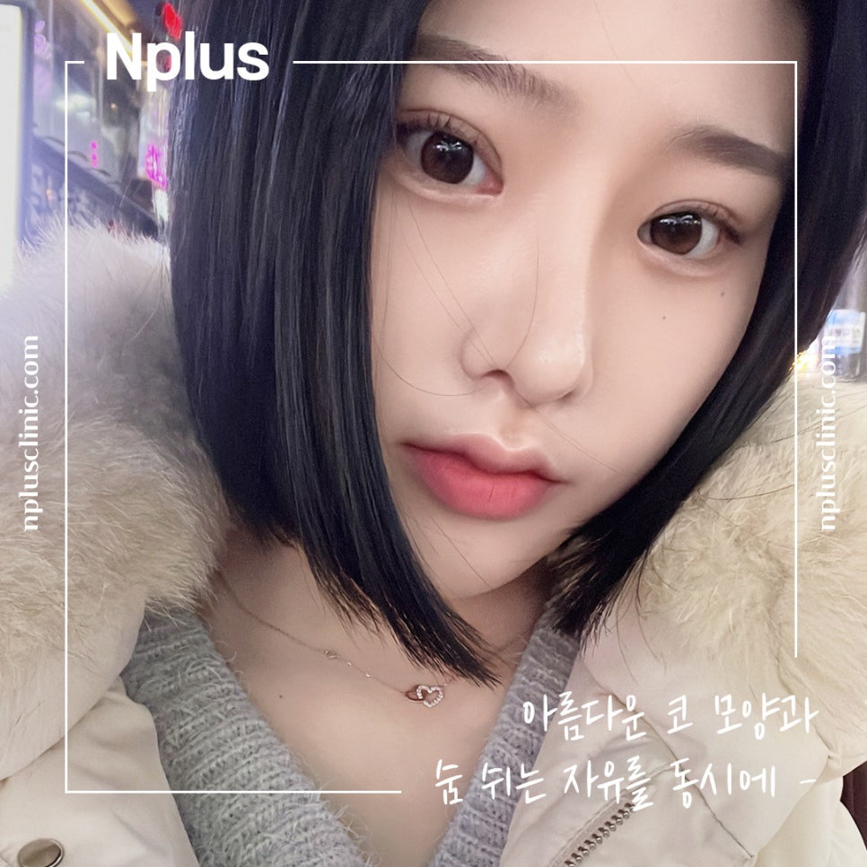 코수술전후 자연스러운 라인으로 관련 이미지 2