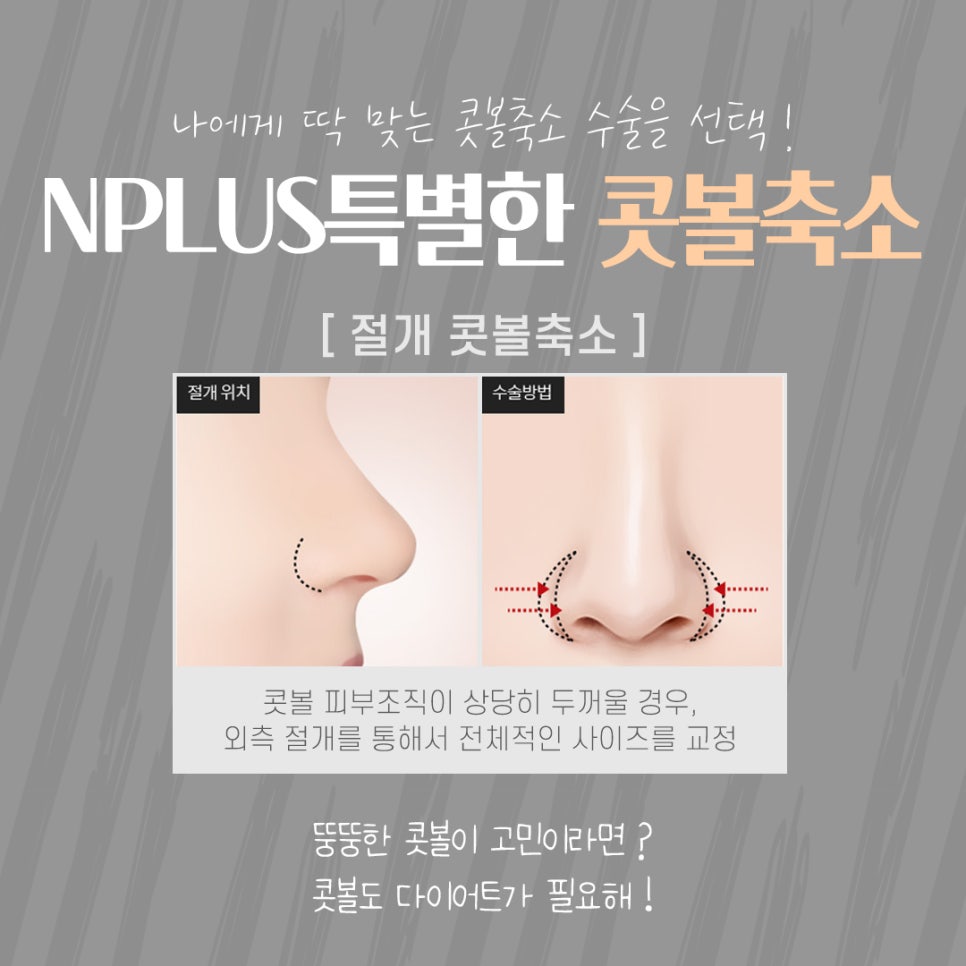 콧볼축소수술후기 내게 어울리는 라인으로 관련 이미지 10