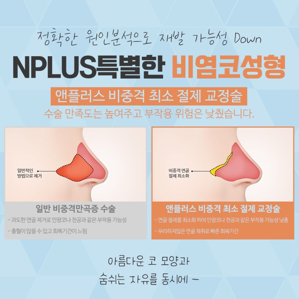 비염수술코성형 한 번의 선택으로 관련 이미지 10