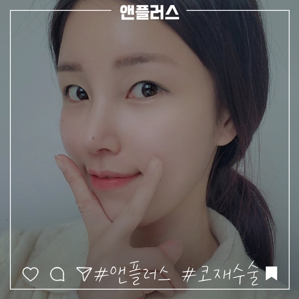 압구정성형외과에서 알아보는 코재수술후기 관련 이미지 1