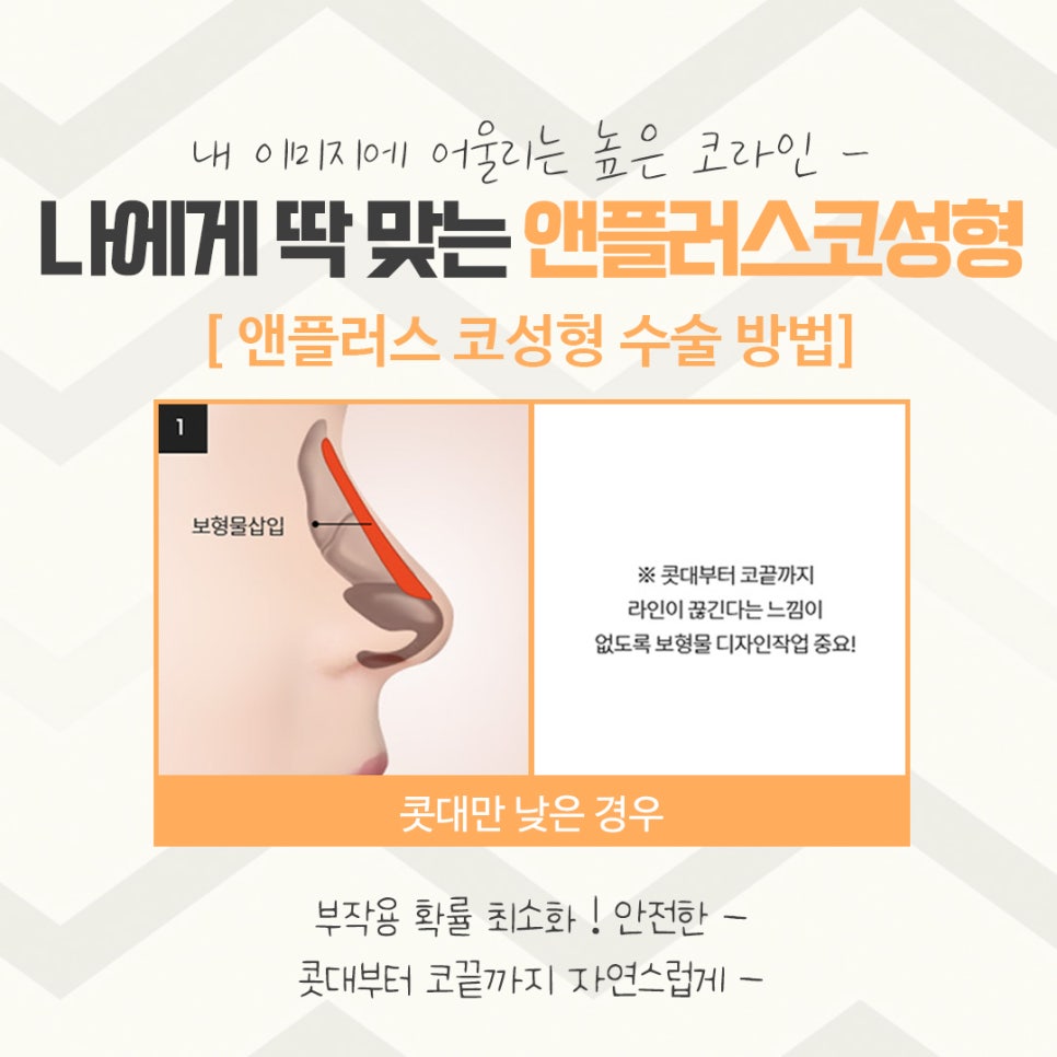 코수술후기에 대해 자세하게 알아보고 관련 이미지 9