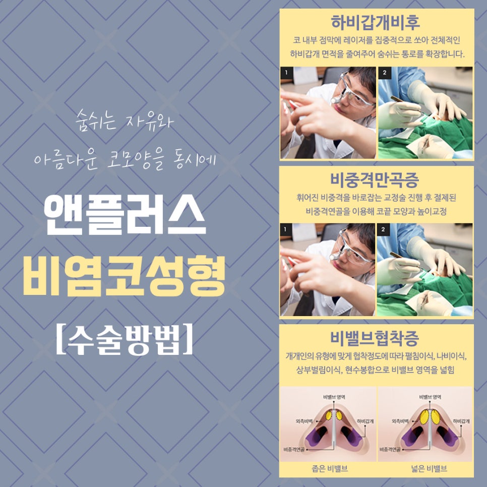 Review of Rhinoplasty for Rhinitis: Check and Decide image 8