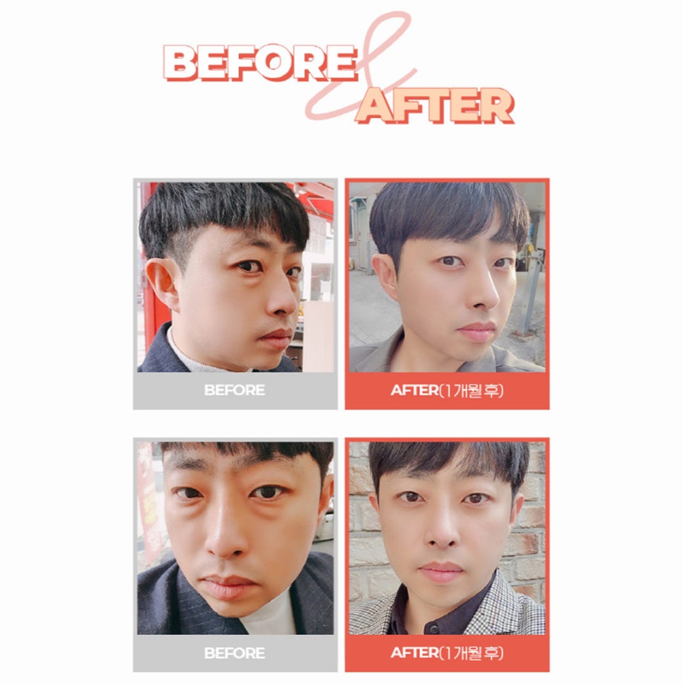 다크서클과 비염! 관계가 있을까요? 관련 이미지 8