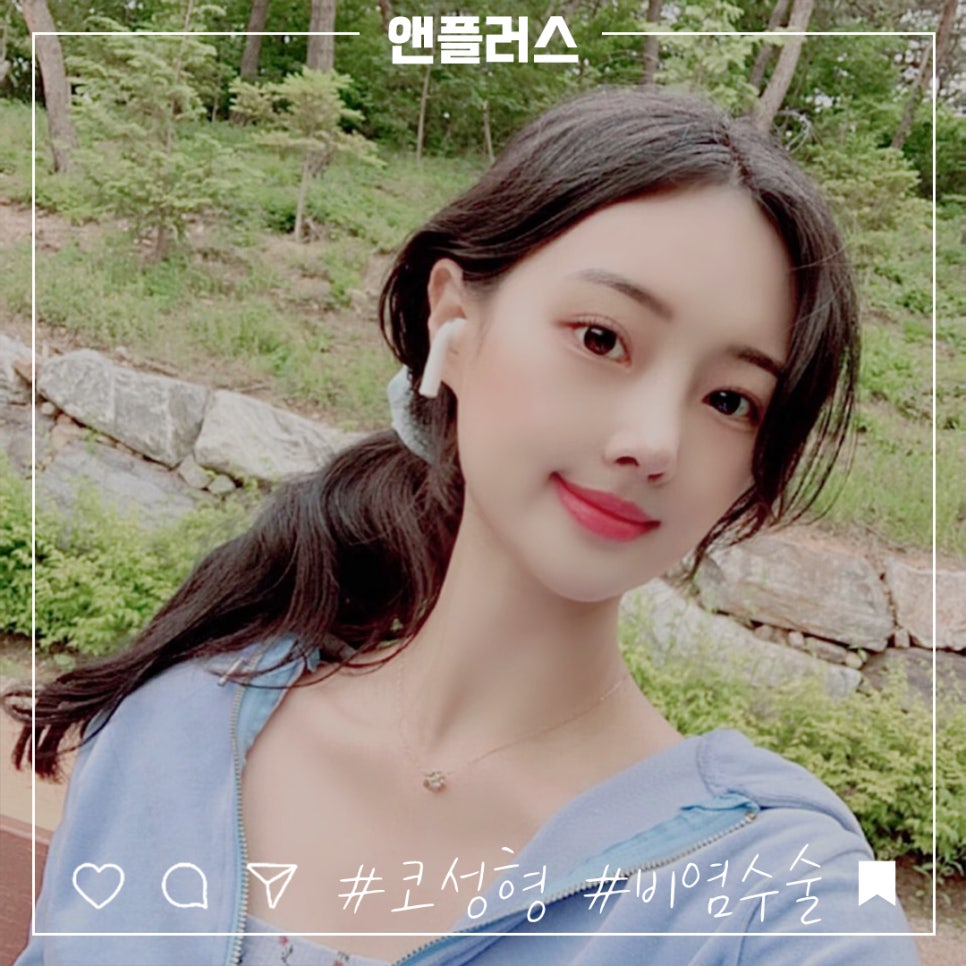 코성형수술과 코필러에 대한 차이점과 장단점 관련 이미지 1
