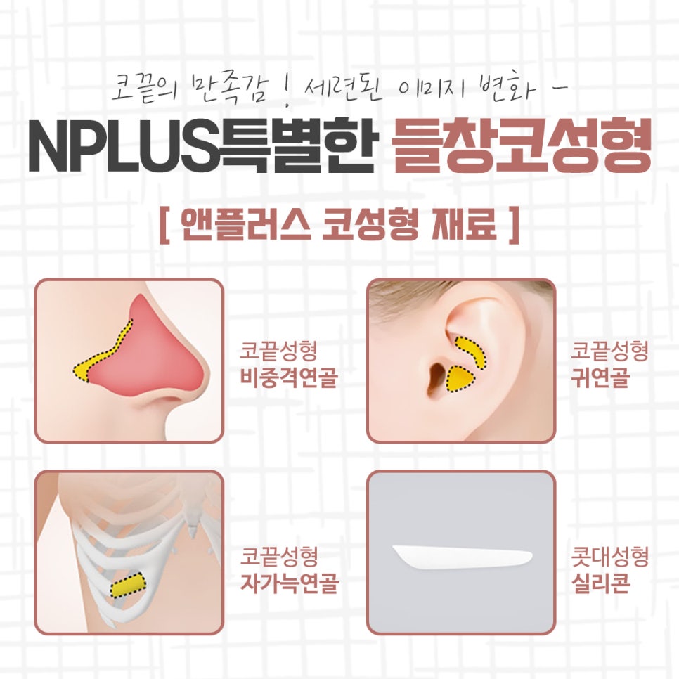 들창코성형 선택의 중요성 관련 이미지 11