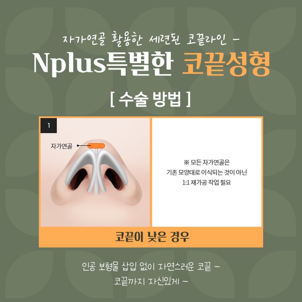 코끝성형으로 자연스럽게 예뻐지자 관련 이미지 8
