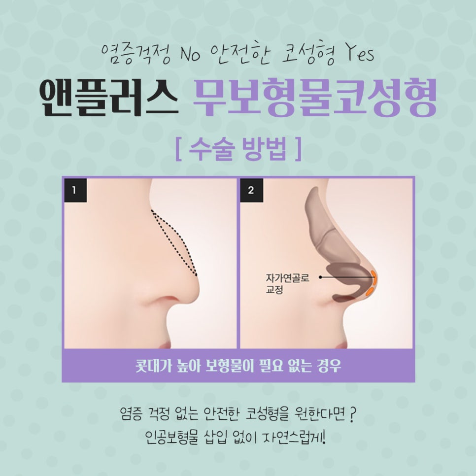 Safety First: Check Reviews of Non-Implant Rhinoplasty image 11
