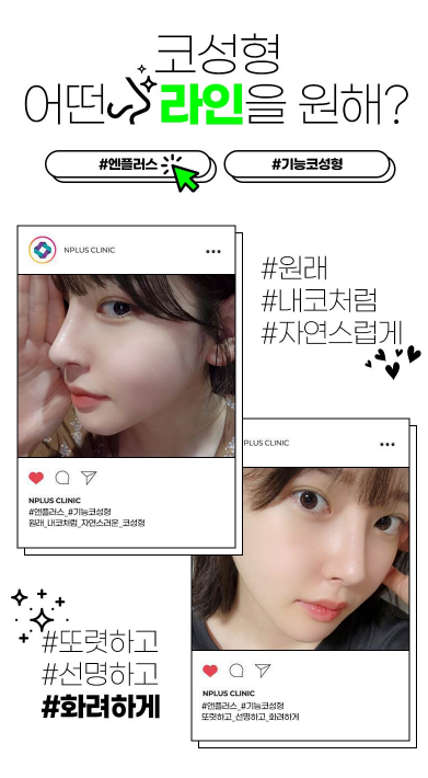 앤플러스에서 진행하는 기능코성형 EVENT 관련 이미지 2