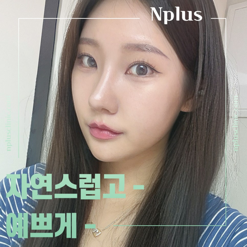 Check the Difference in Autologous Rib Nose Surgery Results image 1