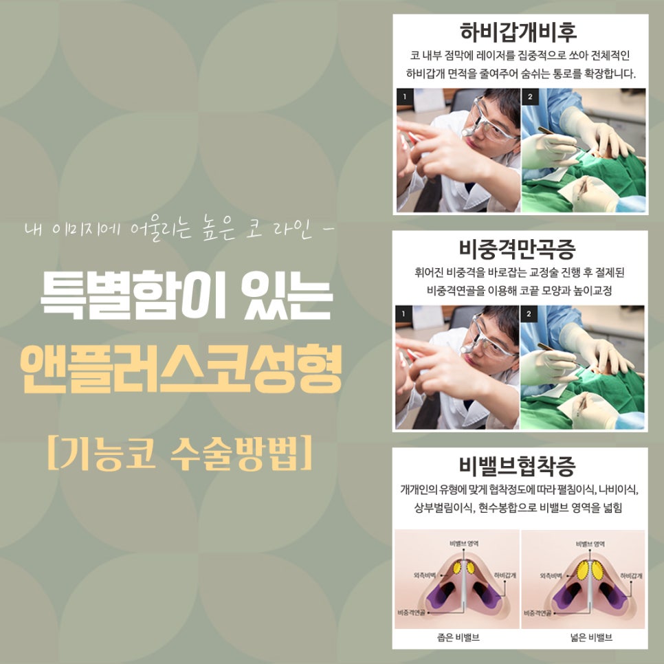 직반버선코 라인으로 교정된 코수술후기 관련 이미지 13