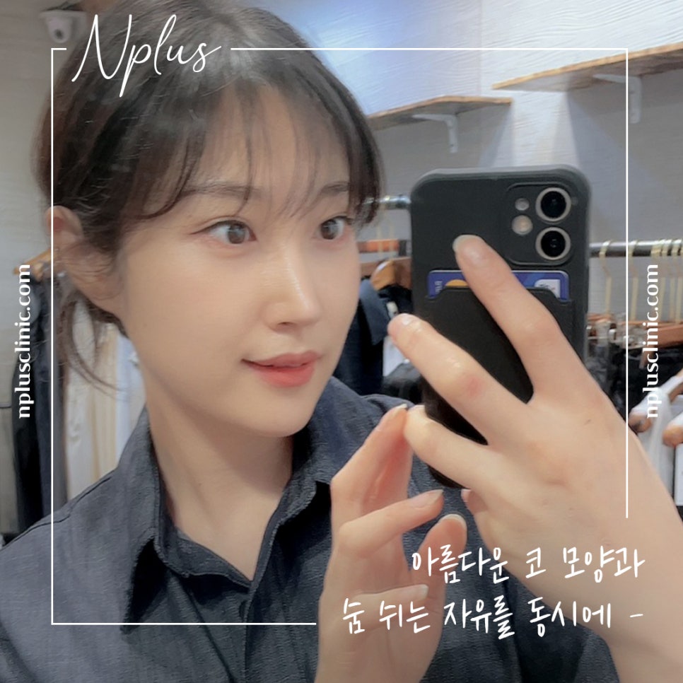 자가늑연골코성형을 통한 이미지 개선 관련 이미지 2