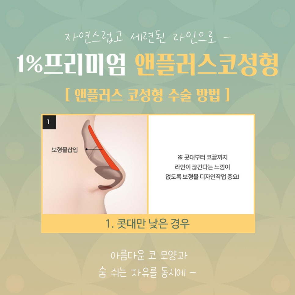 자가늑코성형 정확한 포인트를 파악하여 관련 이미지 7