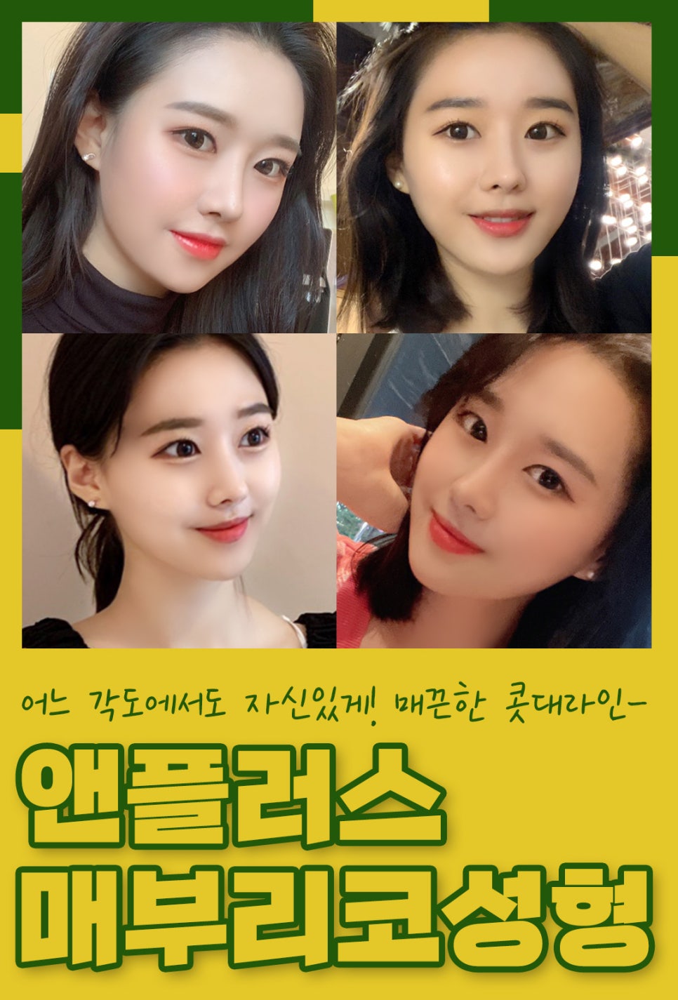 매부리코교정후기_깔끔하게 제거해야 관련 이미지 2