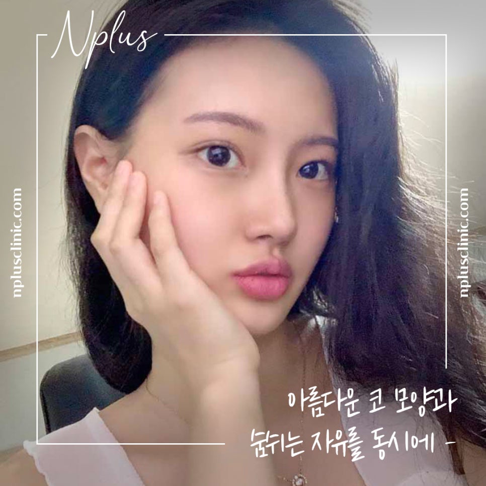 긴코성형으로 교정하고 동안 되자 관련 이미지 13