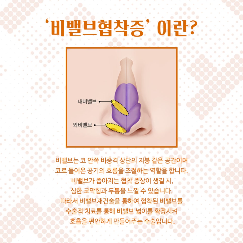 비밸브협착증 코수술방법 완벽 정리 관련 이미지 2