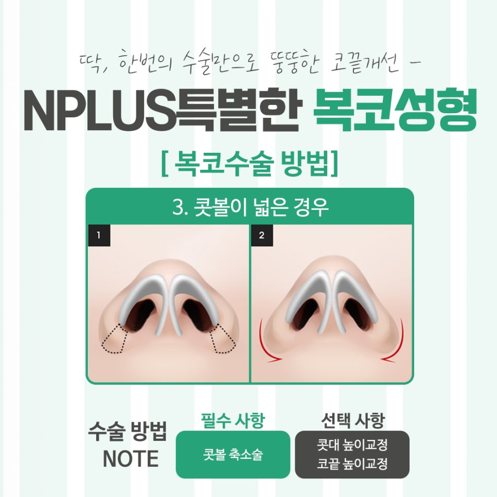 Looking Into Bulbous Nose Surgery Reviews to Improve Your Appearance image 9