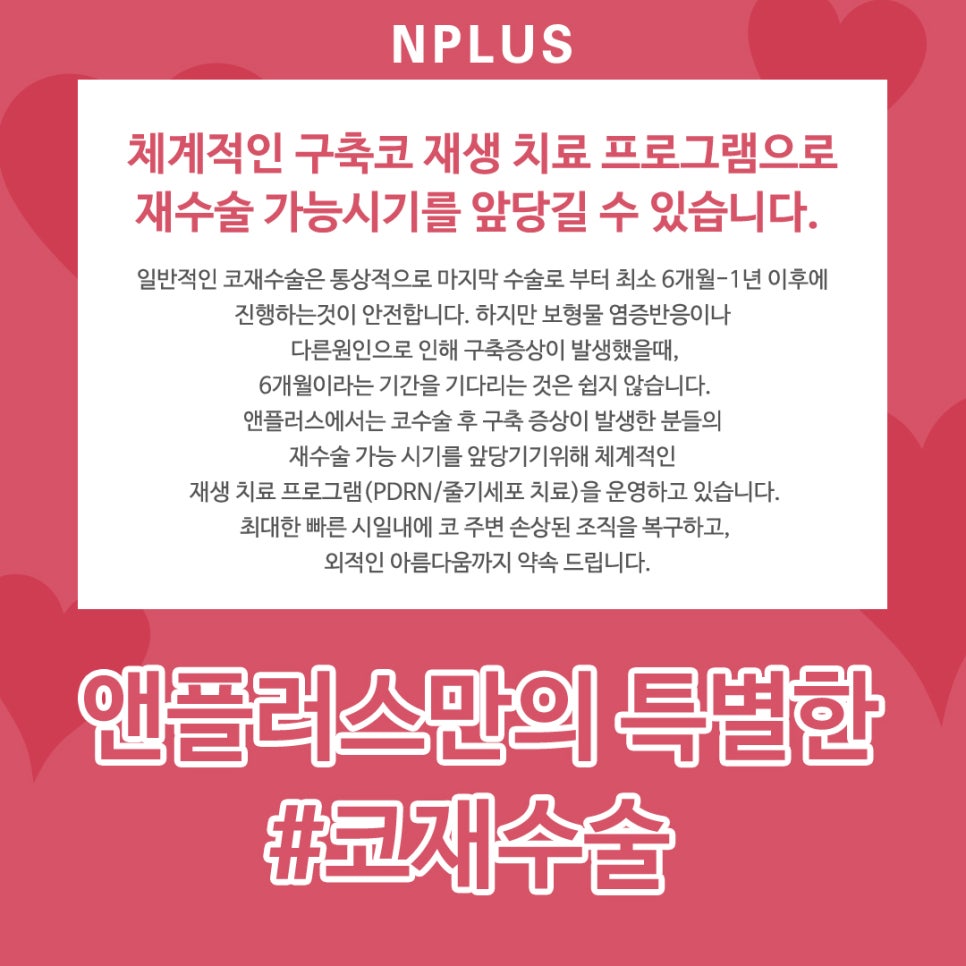압구정성형외과_코재수술 본인 얼굴에 맞게 선택 관련 이미지 2