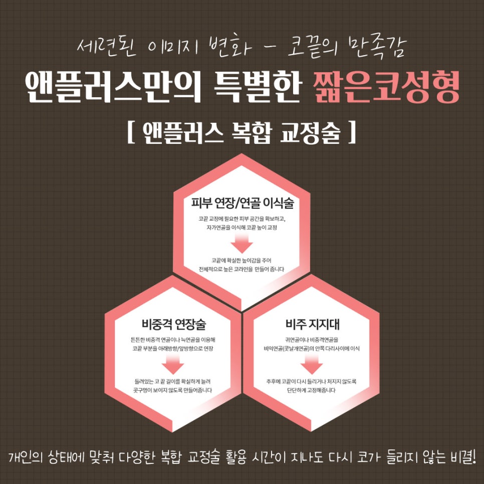 들창코수술후기 튼튼한 비주지지대 관련 이미지 6