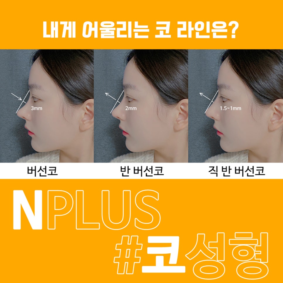 콧대수술_비염기능까지 고려해서 관련 이미지 2