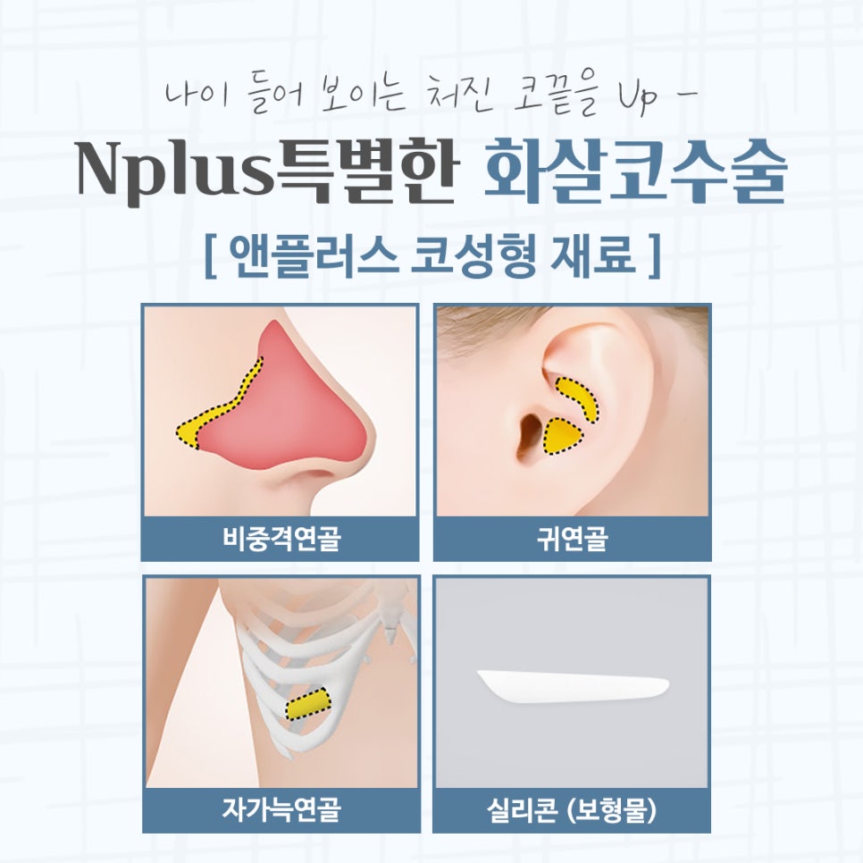 화살코수술 자세하게 알아보고 관련 이미지 11