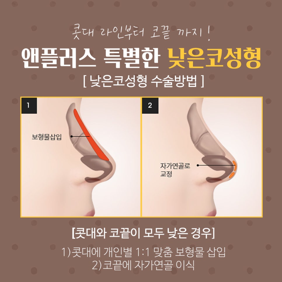 낮은코성형후기 세련된 이미지로 관련 이미지 8