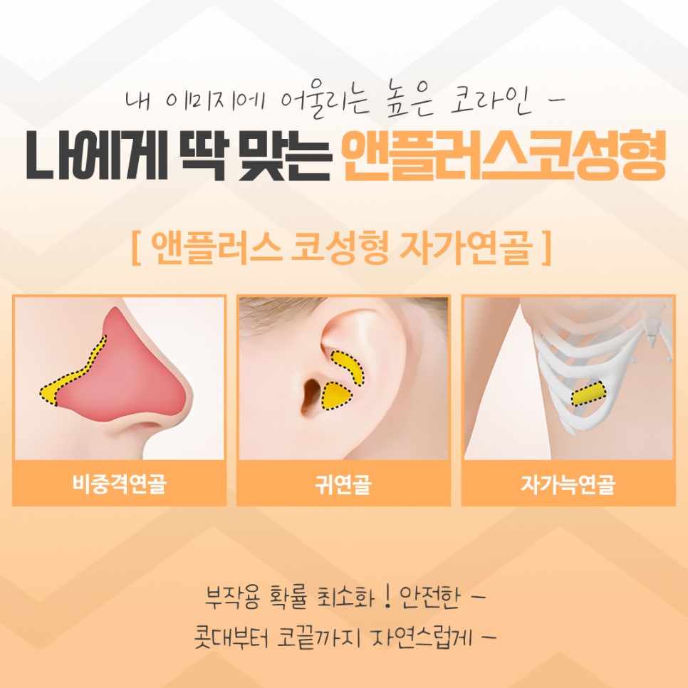 코수술후기에 대해 자세히 찾아보고 관련 이미지 12