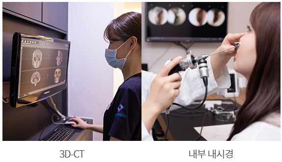 Hooked Nose Before-and-After Photos for a Softer Look image 9