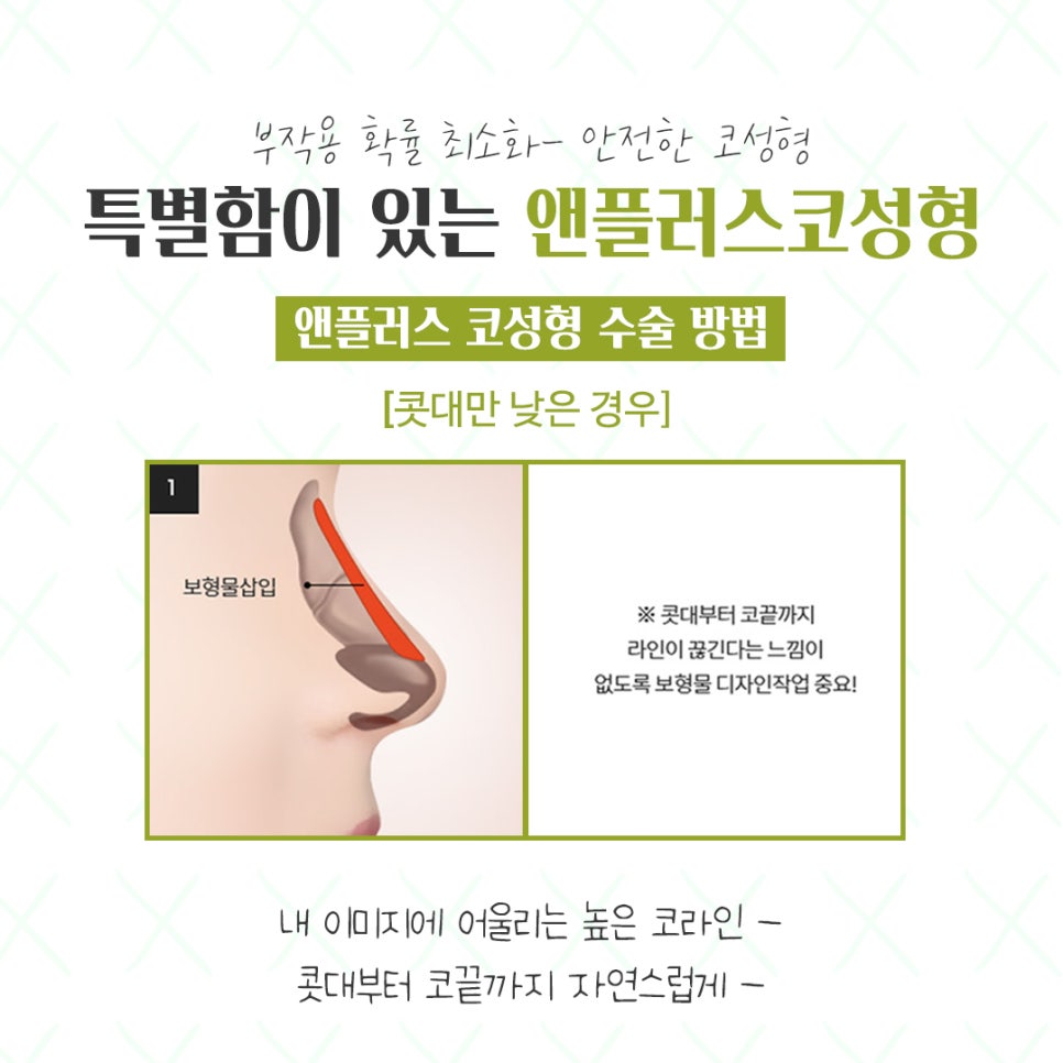 코성형전후를 찾아본다면 관련 이미지 9