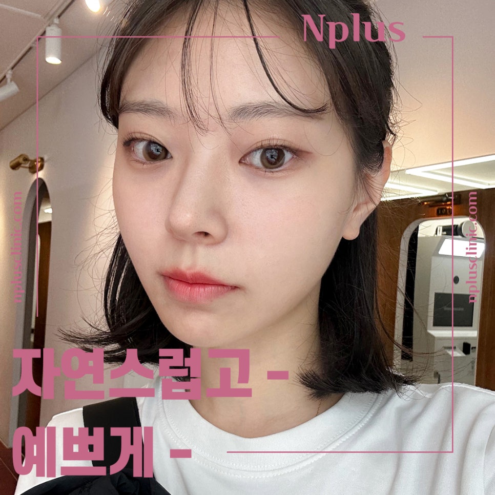 Review of Revision Rhinoplasty: Exploring Various Aspects image 13