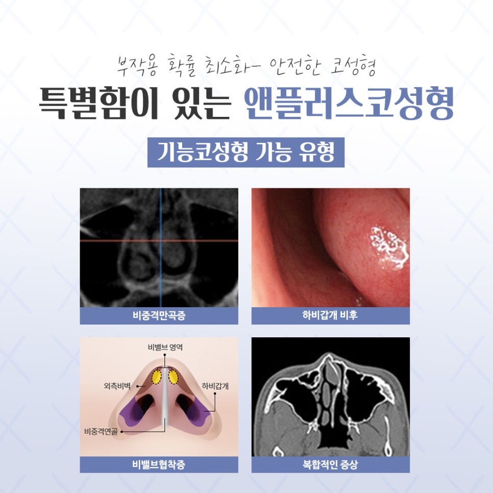코성형전후 개선할 점을 확인하고 관련 이미지 5