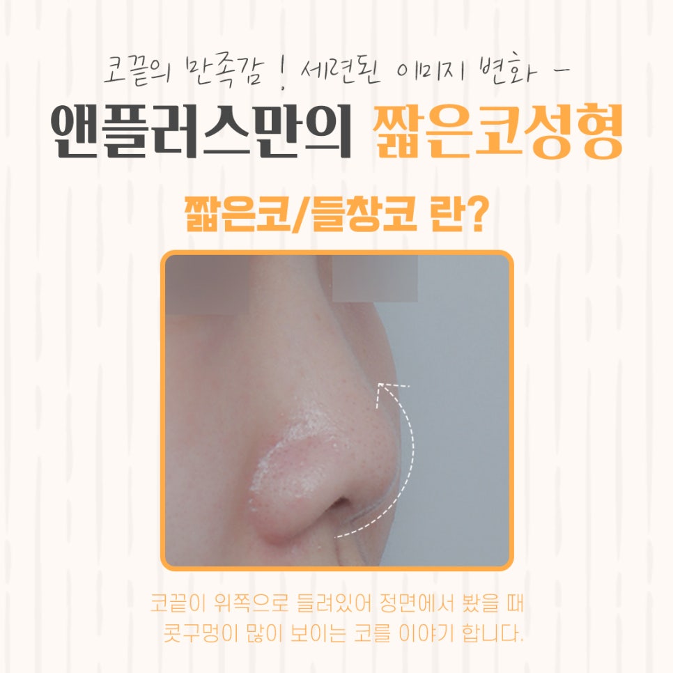 Carefully Checking Short Nose Surgery image 4