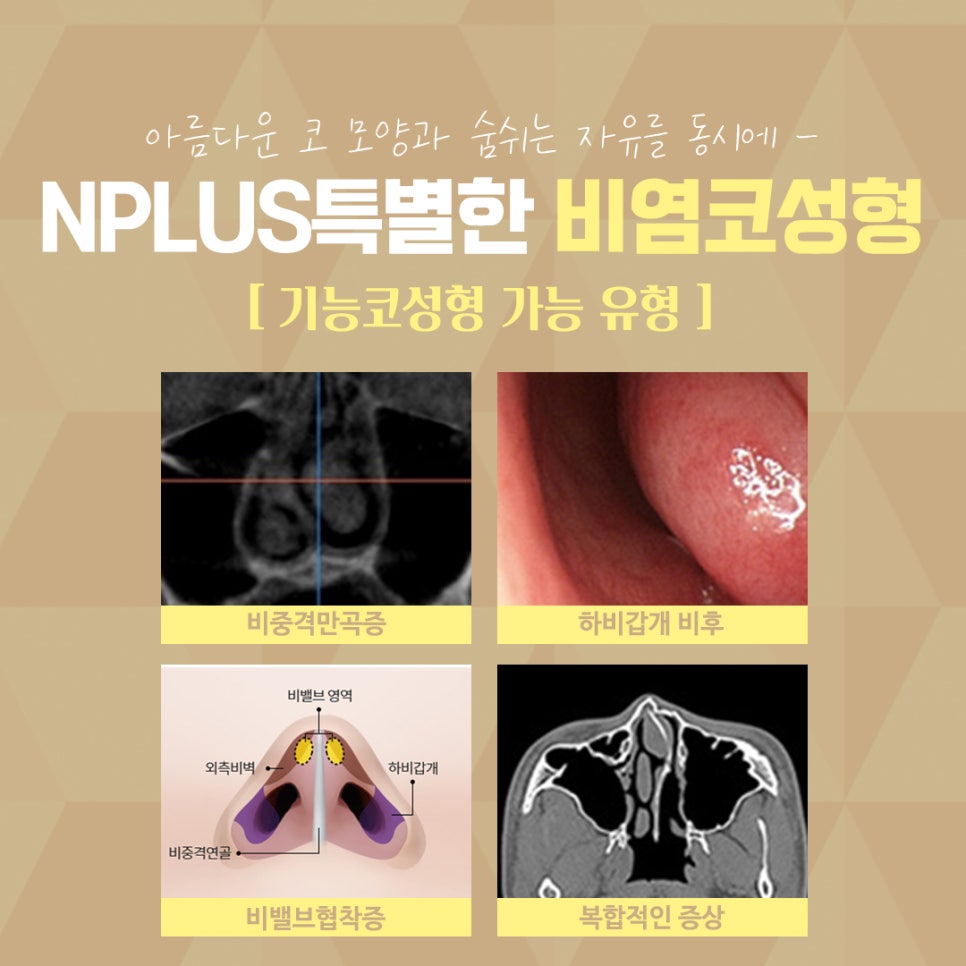 You Should Check the Rhinoplasty and Rhinitis Surgery Reviews Carefully Before Proceeding image 5