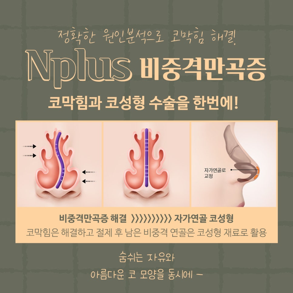 Septoplasty Surgery Explained at Gangnam Nose Surgery image 10
