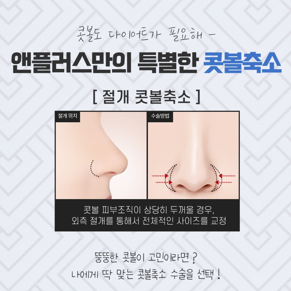콧볼축소수술 확실한 교정으로 관련 이미지 10