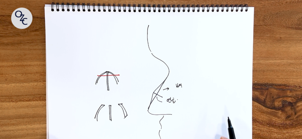 코성형 후에도 매부리재발이 될 수 있나요? 관련 이미지 8