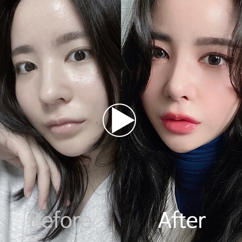 🎀앤플러스 코성형 모델모집🎀 관련 이미지 2