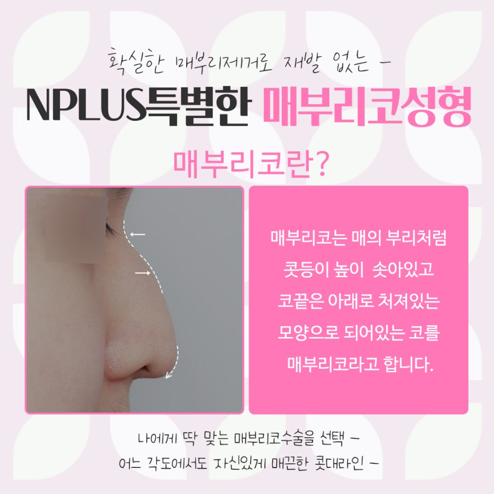 매부리코성형후기를 통해 이미지 개선 관련 이미지 3