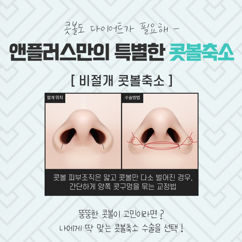 콧볼축소수술후기의 차이를 비교해 보고 관련 이미지 8