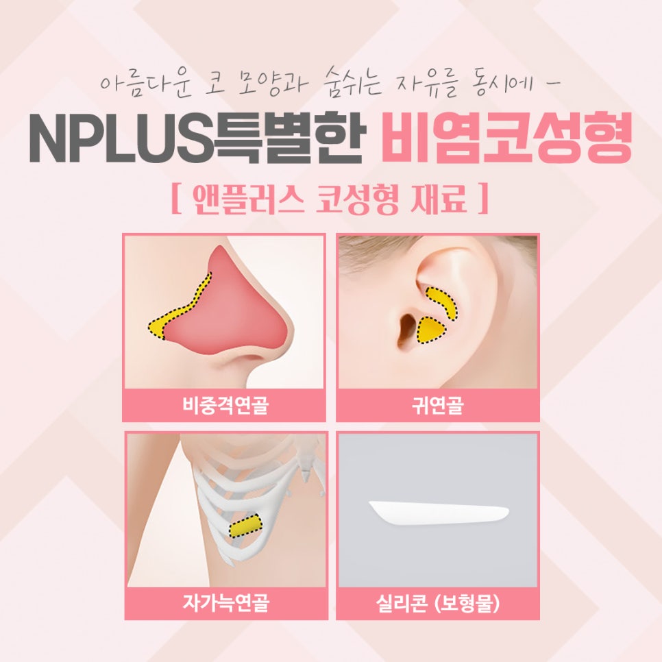 비염코수술후기 확실한 진단으로 관련 이미지 9