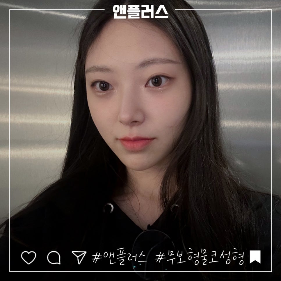 무보형물코성형후기 만족스러운 라인으로 관련 이미지 12