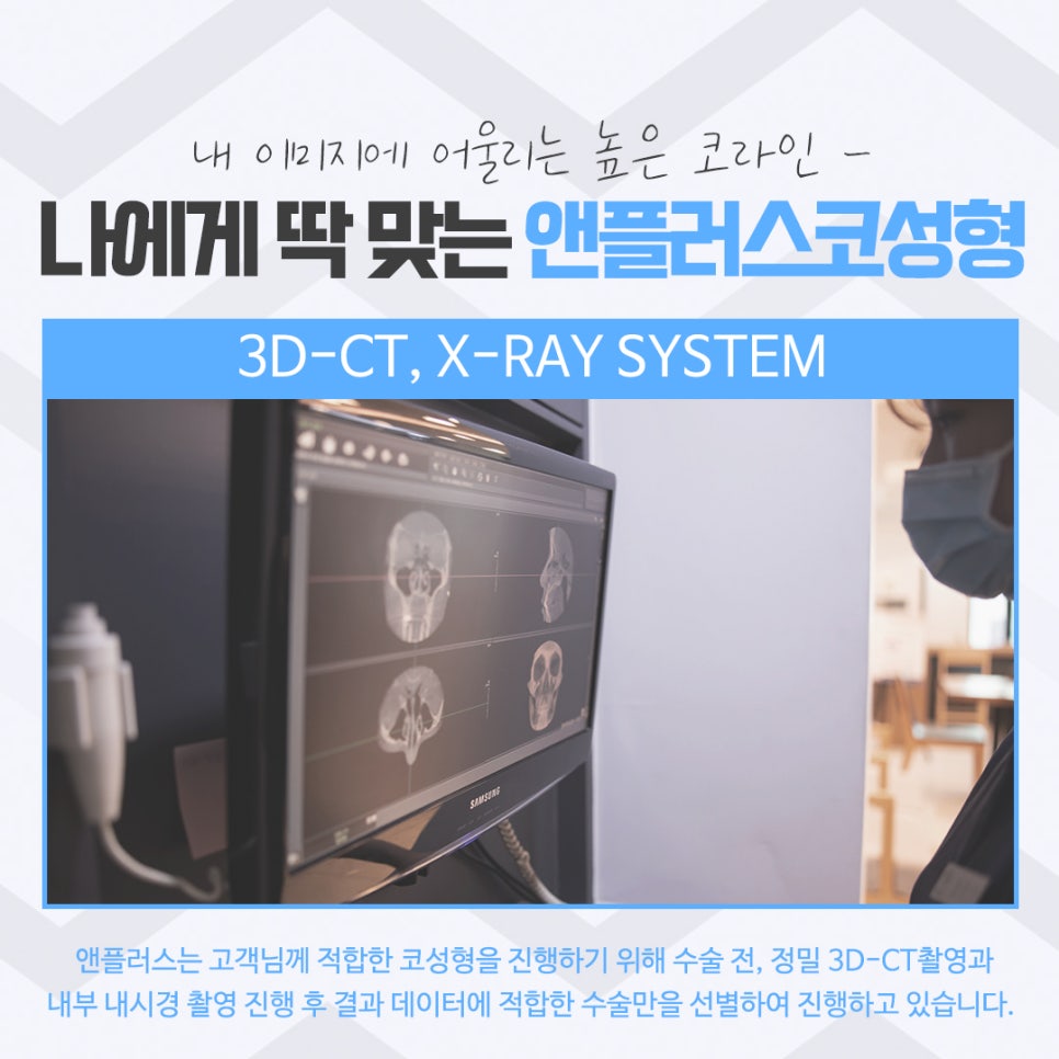 코성형후기를 다양하게 찾아보고 관련 이미지 7