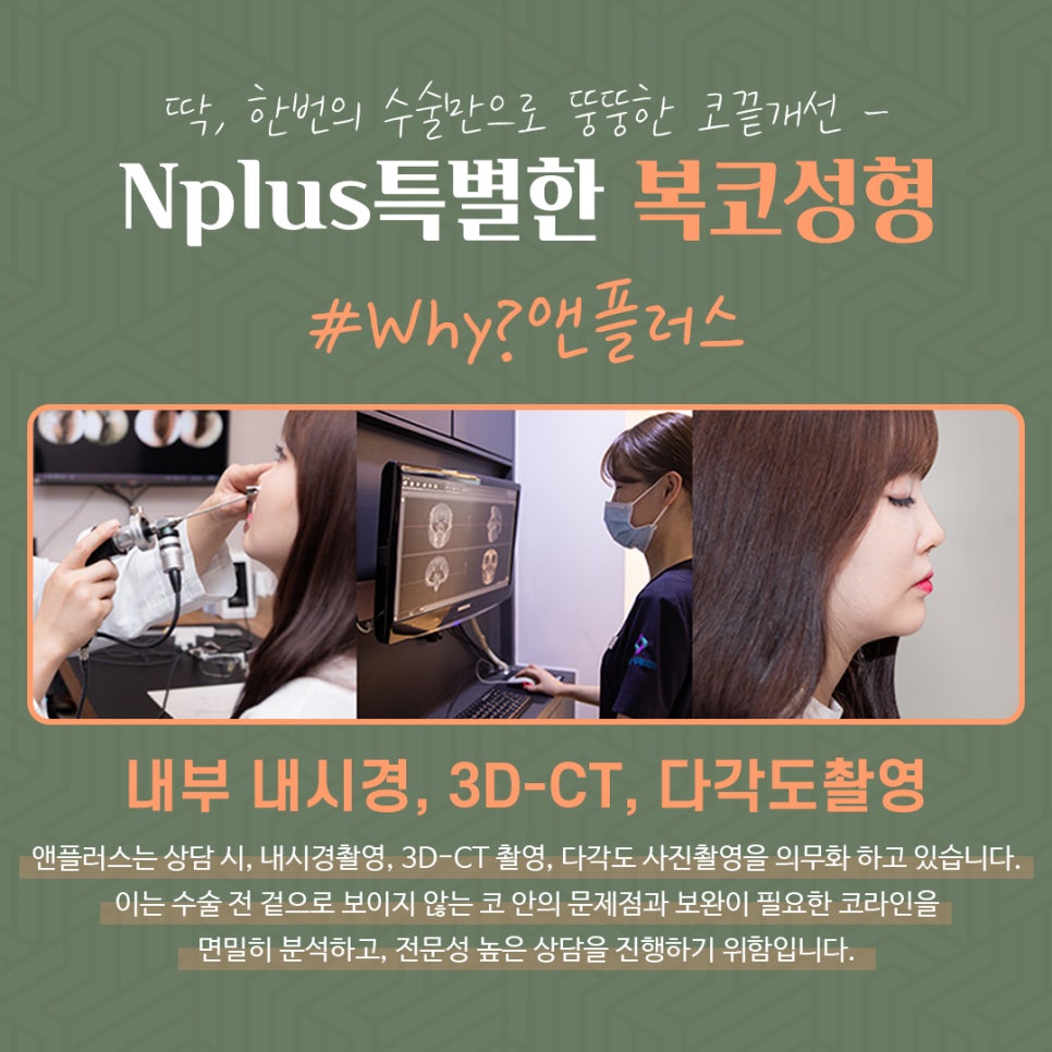 Rhinoplasty Review for a Bulbous Nose Through Nose Fat Removal image 11