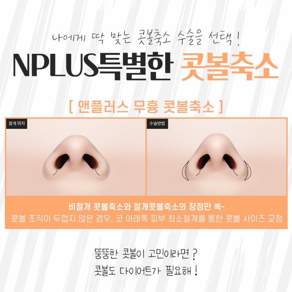 Looking into Nasal Ala Reduction Surgery Methods image 8