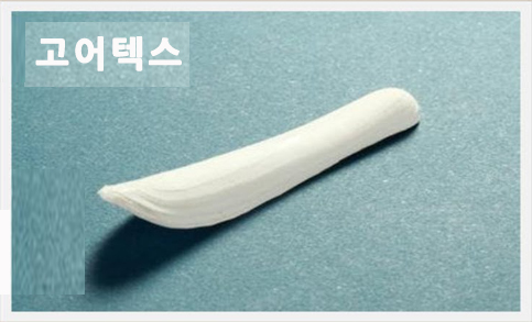 코재건 수술할때 꼭 알아두어야 할 상식! 관련 이미지 4