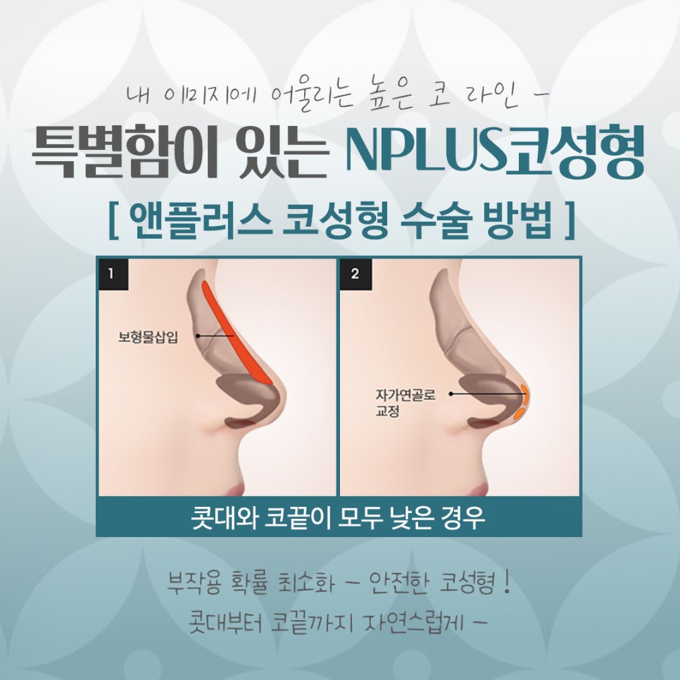 Looking Into Information About Gangnam Nose Surgery image 8
