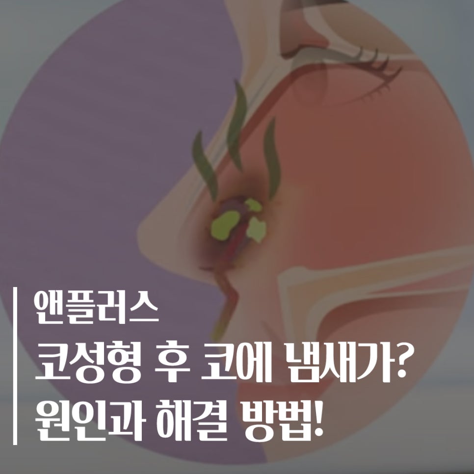 코수술 후 코냄새 원인과 해결 방법! 관련 이미지 1