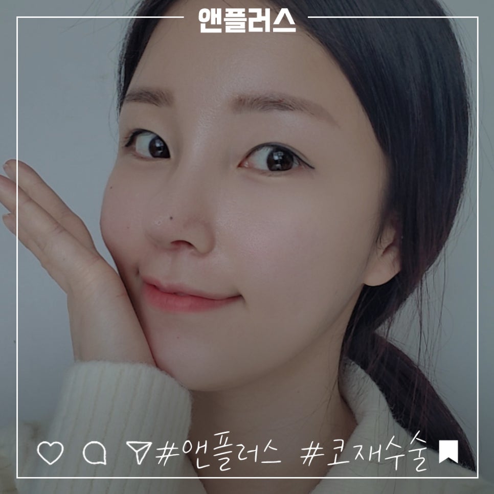 압구정성형외과에서 알아보는 코재수술후기 관련 이미지 3